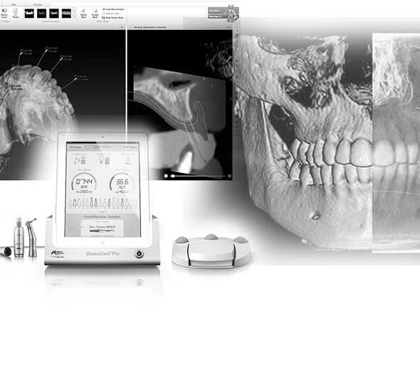 Strumentazione digitale e immagini 3D del cranio